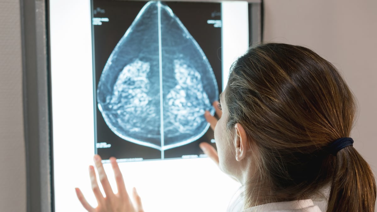 Andalucía, Valencia, Baleares, Aragón y Navarra ocultan las listas de espera de las pruebas radiológicas