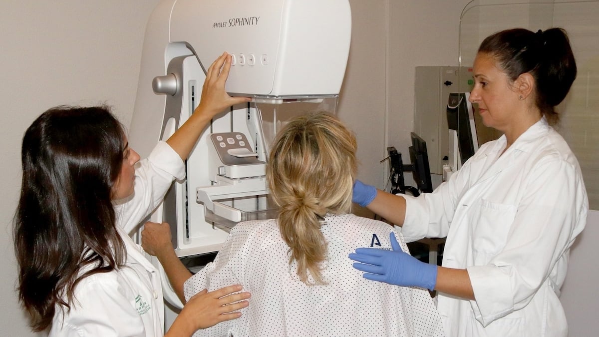 Los radiólogos advierten de que la crisis de los cribados en Andalucía es estructural: “El cáncer de mama es la punta del iceberg”
