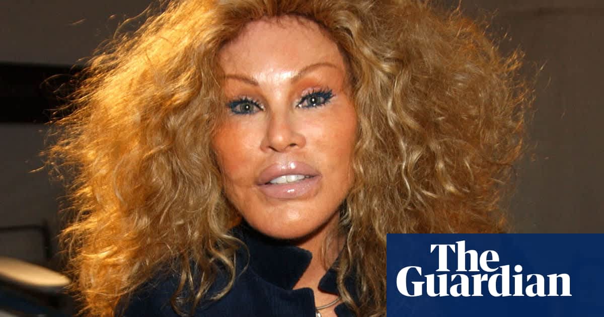 Jocelyne Wildenstein, socialite known for extreme cat-like plastic surgery, dies